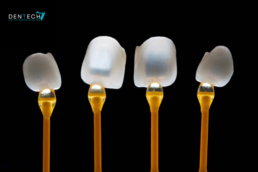 Patru fatete dentare ceramice expuse pe suporturi în laborator dentar