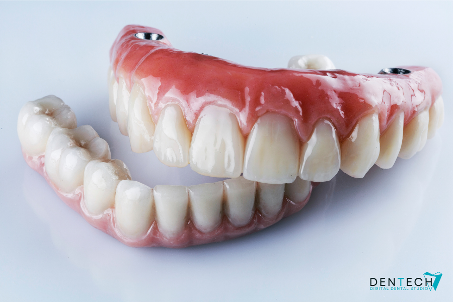 Zirconiu pe implanturi dentare All on 4 si All on 6