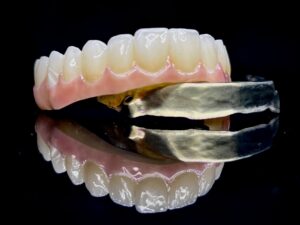Structura de Zirconiu pe Bara de Titan iBar Implanturi MultiUnit